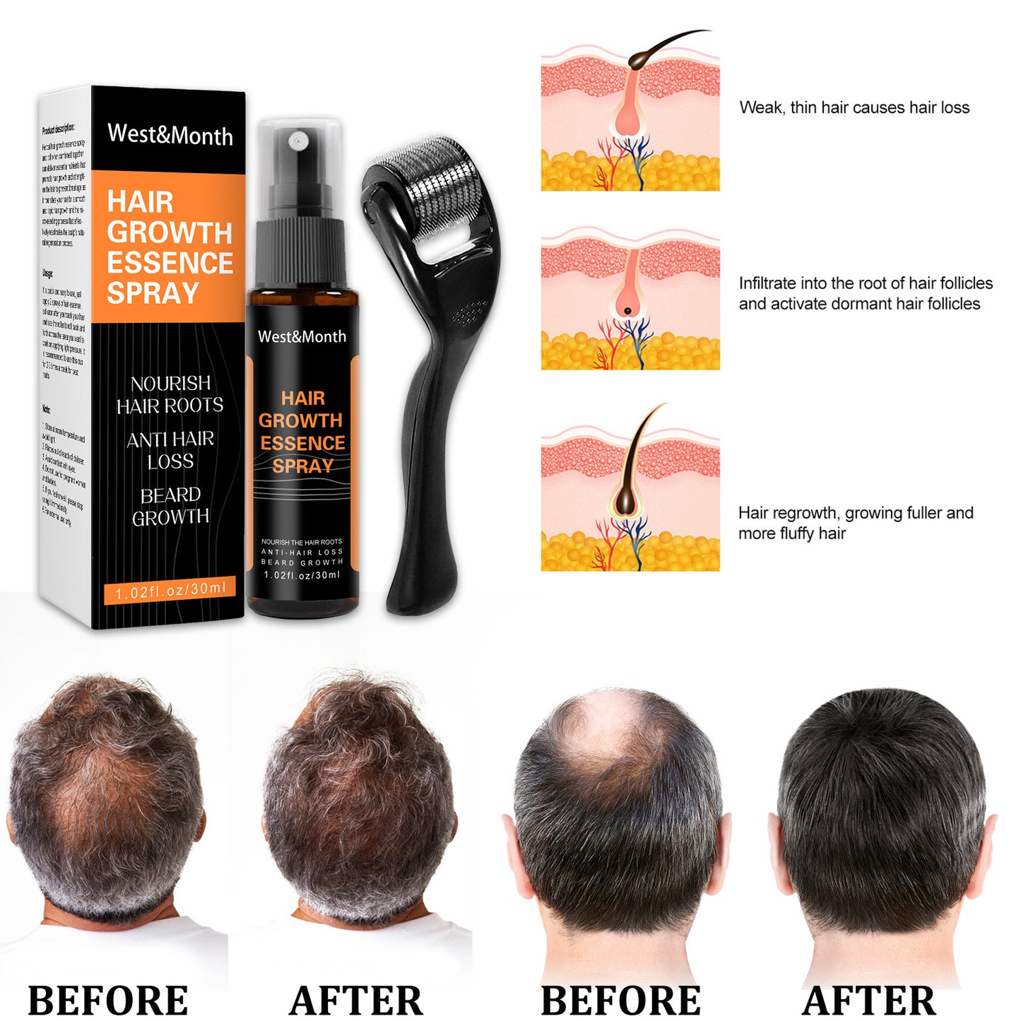 Hair Growth Spray Anti-hair Nourishing Growth Liquid